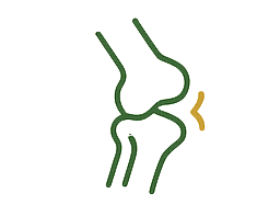 Xương khớp – Gout