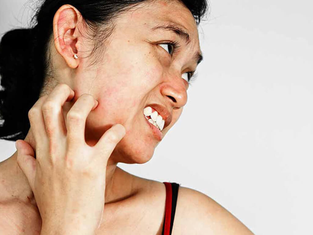 Triệu chứng bệnh thận - làn da khô ngứa ngáy