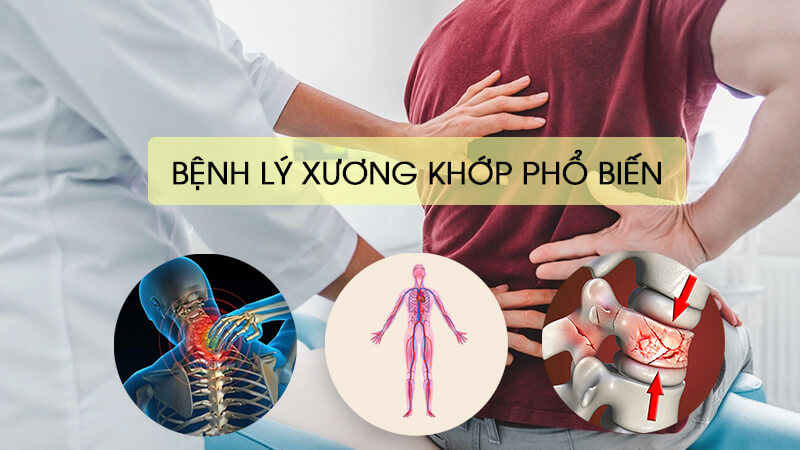 các bệnh lý cơ xương khớp phổ biến khi ngồi nhiều