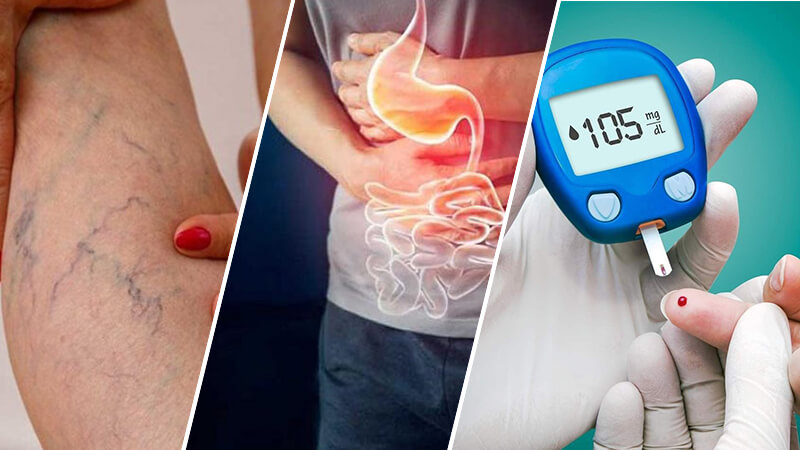 Bệnh mãn tính của dân văn phòng khi ngồi nhiều