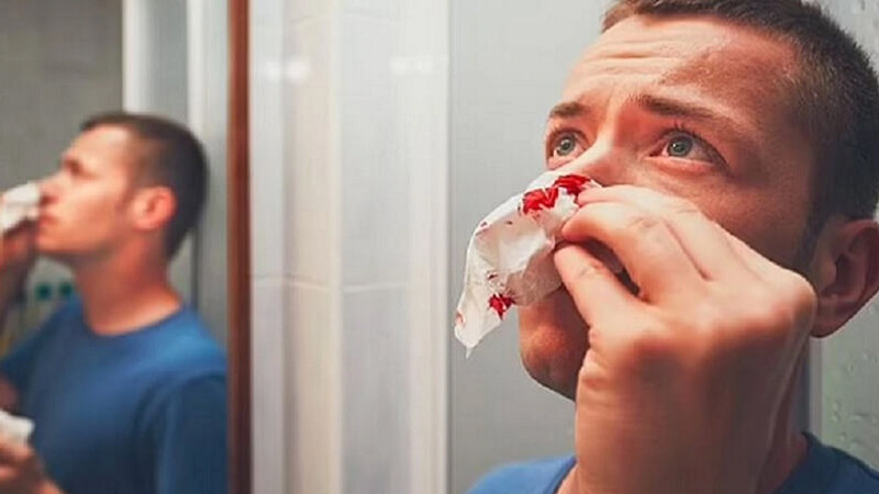 Chảy máu cam triệu chứng tăng huyết áp